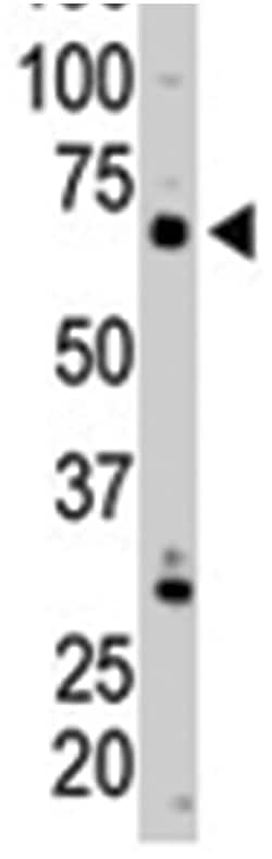 PIP5K1C Rabbit anti-Human, Polyclonal Antibody, Abnova 400&mu;L; Unlabeled:Antibodies,