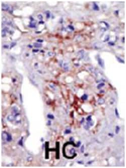 PIP5K1C Rabbit anti-Human, Polyclonal Antibody, Abnova 400&mu;L; Unlabeled:Antibodies,