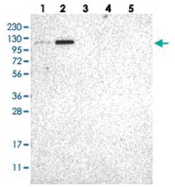 AASS Rabbit anti-Human, Polyclonal Antibody, Abnova 100 &mu;L | Buy Online | Abnova Corporation | Fisher Scientific