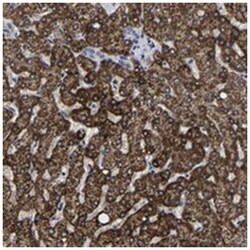 AASS Rabbit anti-Human, Polyclonal Antibody, Abnova 100 &mu;L | Buy Online | Abnova Corporation | Fisher Scientific