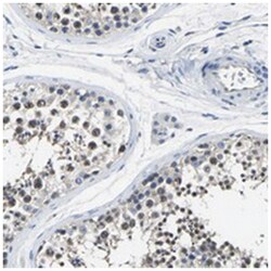 STRBP, Rabbit, Polyclonal Antibody, Abnova 100 &mu;L | Buy Online | Abnova Corporation | Fisher Scientific