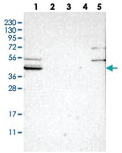 SLCO2B1, Rabbit, Polyclonal Antibody, Abnova 100 &mu;L | Buy Online | Abnova Corporation | Fisher Scientific