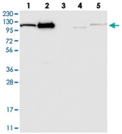 AASS Rabbit anti-Human, Polyclonal Antibody, Abnova 100&mu;L; Unlabeled:Antibodies,