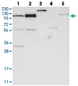 AASS Rabbit anti-Human, Polyclonal Antibody, Abnova 100 &mu;L | Buy Online | Abnova Corporation | Fisher Scientific