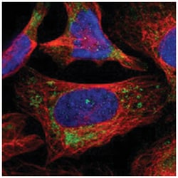 AASS Rabbit anti-Human, Polyclonal Antibody, Abnova 100 &mu;L | Buy Online | Abnova Corporation | Fisher Scientific