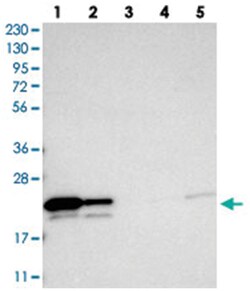 GGCT Rabbit anti-Human, Polyclonal Antibody, Abnova 100 &mu;L | Buy Online | Abnova Corporation | Fisher Scientific