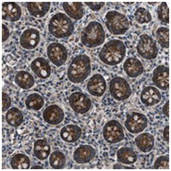 GGCT Rabbit anti-Human, Polyclonal Antibody, Abnova 100 &mu;L | Buy Online | Abnova Corporation | Fisher Scientific