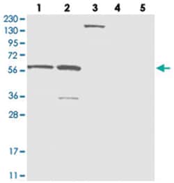 ZNF250, Rabbit, Polyclonal Antibody, Abnova 100&mu;L; Unlabeled:Antibodies,