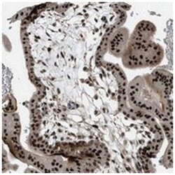 ZNF250, Rabbit, Polyclonal Antibody, Abnova 100&mu;L; Unlabeled:Antibodies,