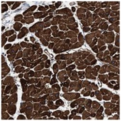 C9orf75, Rabbit, Polyclonal Antibody, Abnova 100 &mu;L | Buy Online | Abnova Corporation | Fisher Scientific