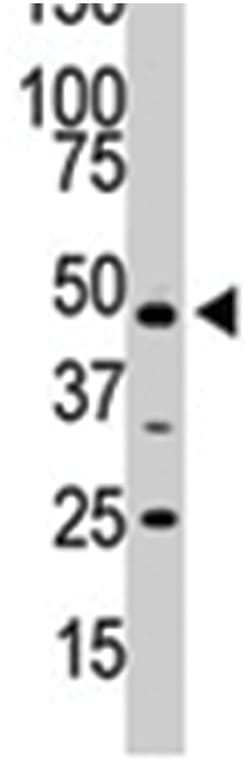 PIP4K2A Rabbit anti-Human, Polyclonal Antibody, Abnova 400 &mu;L | Buy Online | Abnova Corporation | Fisher Scientific