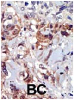PIP4K2A Rabbit anti-Human, Polyclonal Antibody, Abnova 400 &mu;L | Buy Online | Abnova Corporation | Fisher Scientific