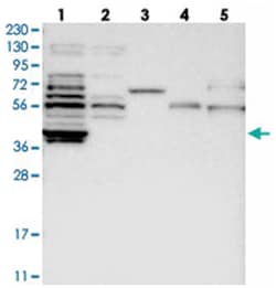 KIAA1045, Rabbit, Polyclonal Antibody, Abnova 100 &mu;L | Buy Online | Abnova Corporation | Fisher Scientific