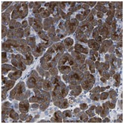 KIAA1045, Rabbit, Polyclonal Antibody, Abnova 100 &mu;L | Buy Online | Abnova Corporation | Fisher Scientific