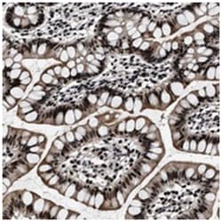 ZNF233, Rabbit, Polyclonal Antibody, Abnova 100&mu;L; Unlabeled:Antibodies,