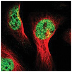 ZNF233, Rabbit, Polyclonal Antibody, Abnova 100&mu;L; Unlabeled:Antibodies,