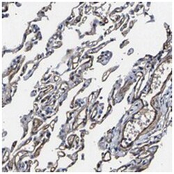 KLHDC5, Rabbit, Polyclonal Antibody, Abnova 100 &mu;L | Buy Online | Abnova Corporation | Fisher Scientific