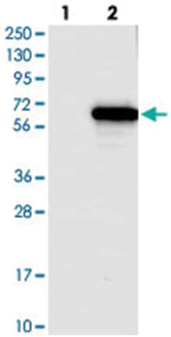 KLHDC5, Rabbit, Polyclonal Antibody, Abnova 100 &mu;L | Buy Online | Abnova Corporation | Fisher Scientific