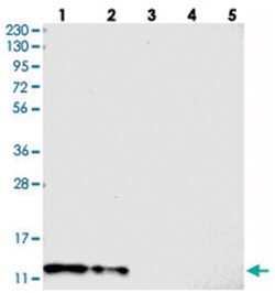 C7orf59, Rabbit, Polyclonal Antibody, Abnova 100&mu;L; Unlabeled:Antibodies,