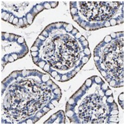 C7orf59, Rabbit, Polyclonal Antibody, Abnova 100&mu;L; Unlabeled:Antibodies,