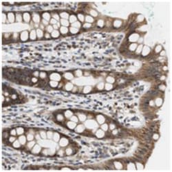 GIGYF1 Rabbit anti-Human, Polyclonal Antibody, Abnova 100&mu;L; Unlabeled:Antibodies,