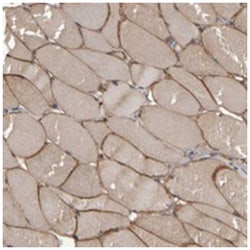 MURC Rabbit anti-Human, Polyclonal Antibody, Abnova 100 &mu;L | Buy Online | Abnova Corporation | Fisher Scientific