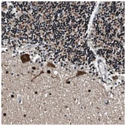 BAT2L, Rabbit, Polyclonal Antibody, Abnova 100 &mu;L | Buy Online | Abnova Corporation | Fisher Scientific