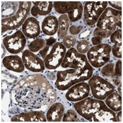 LRRC14, Rabbit, Polyclonal Antibody, Abnova 100 &mu;L | Buy Online | Abnova Corporation | Fisher Scientific