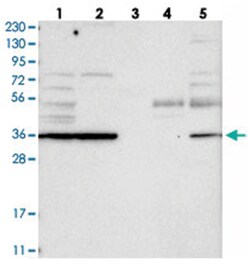 TPST2 Rabbit anti-Human, Polyclonal Antibody, Abnova 100 &mu;L | Buy Online | Abnova Corporation | Fisher Scientific