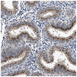 TPST2 Rabbit anti-Human, Polyclonal Antibody, Abnova 100 &mu;L | Buy Online | Abnova Corporation | Fisher Scientific