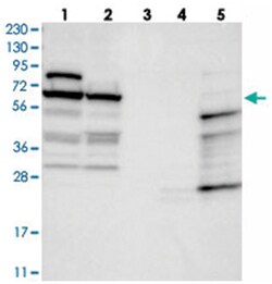 NOP5/NOP58 Rabbit anti-Human, Polyclonal Antibody, Abnova 100&mu;L; Unlabeled:Antibodies,