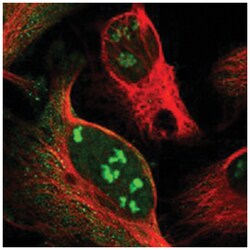 NOP5/NOP58 Rabbit anti-Human, Polyclonal Antibody, Abnova 100&mu;L; Unlabeled:Antibodies,