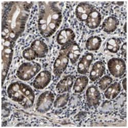 GTPBP10, Rabbit, Polyclonal Antibody, Abnova 100&mu;L; Unlabeled:Antibodies,