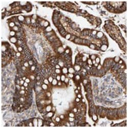 RGP1 Rabbit anti-Human, Polyclonal Antibody, Abnova 100&mu;L; Unlabeled:Antibodies,