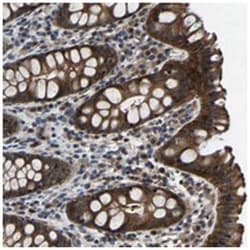 MYO18A Rabbit anti-Human, Polyclonal Antibody, Abnova 100 &mu;L | Buy Online | Abnova Corporation | Fisher Scientific