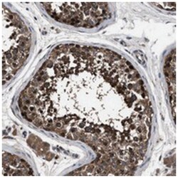 RNF216 Rabbit anti-Human, Polyclonal Antibody, Abnova 100&mu;L; Unlabeled:Antibodies,