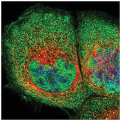 RNF216 Rabbit anti-Human, Polyclonal Antibody, Abnova 100&mu;L; Unlabeled:Antibodies,