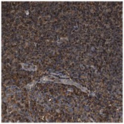 KBTBD2 Rabbit anti-Human, Polyclonal Antibody, Abnova 100 &mu;L | Buy Online | Abnova | Fisher Scientific