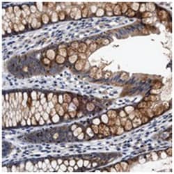 TMEM53, Rabbit, Polyclonal Antibody, Abnova 100 &mu;L | Buy Online | Abnova Corporation | Fisher Scientific