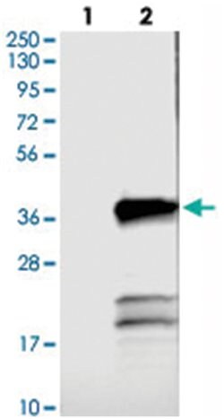 TMEM53, Rabbit, Polyclonal Antibody, Abnova 100 &mu;L | Buy Online | Abnova Corporation | Fisher Scientific