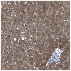 PPM2C Rabbit anti-Human, Polyclonal Antibody, Abnova 100&mu;L; Unlabeled:Antibodies,