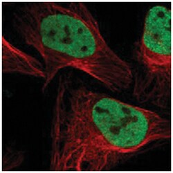 SMARCC2 Rabbit anti-Human, Polyclonal Antibody, Abnova 100&mu;L; Unlabeled:Antibodies,