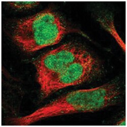 C9orf78 Rabbit anti-Human, Polyclonal Antibody, Abnova 100&mu;L; Unlabeled:Antibodies,