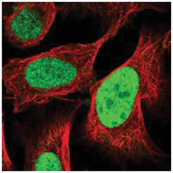 C9orf78 Rabbit anti-Human, Polyclonal Antibody, Abnova 100 &mu;L | Buy Online | Abnova Corporation | Fisher Scientific