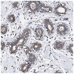 KRBA1, Rabbit, Polyclonal Antibody, Abnova 100 &mu;L | Buy Online | Abnova Corporation | Fisher Scientific