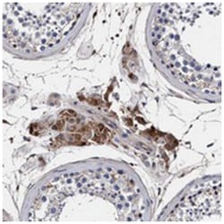 RNF208 Rabbit anti-Human, Polyclonal Antibody, Abnova 100 &mu;L | Buy Online | Abnova Corporation | Fisher Scientific