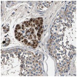 AAED1, Rabbit, Polyclonal Antibody, Abnova 100 &mu;L | Buy Online | Abnova Corporation | Fisher Scientific