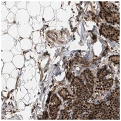 RUSC2 Rabbit anti-Human, Polyclonal Antibody, Abnova 100 &mu;L | Buy Online | Abnova Corporation | Fisher Scientific