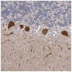 DLG2, Rabbit, Polyclonal Antibody, Abnova 100&mu;L; Unlabeled:Antibodies,