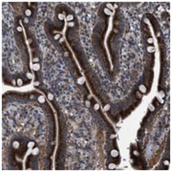 HSD17B4 Rabbit anti-Human, Polyclonal Antibody, Abnova 100&mu;L; Unlabeled:Antibodies,